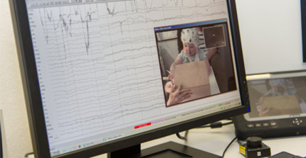 Es ist ein Computerbildschirm abgebildert, auf welchem EEG-Signale zu sehen sind