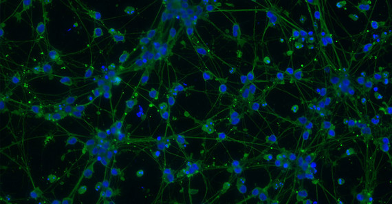 Fluoreszenzmikroskopische Aufnahme von menschlichen Neuronen; grün: das neuronale Netzwerk, blau: die Zellkerne. | Foto: Tanja Schwerdtle.