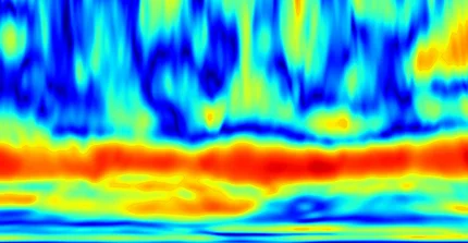 Wavelet eines mechanomyografisch erhobenen Signals eines Muskels