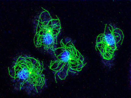 Dictyostelium amoebae with labeled microtubule system