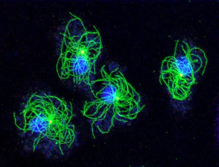 Dictyostelium amoebae with labeled microtubule system