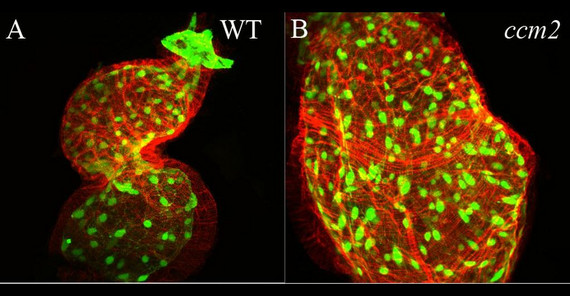 Konfokalmikroskopische Aufnahme des Herzens eines Zebrafischembryos. Der Verlust eines bestimmten Proteins führt zu einer ballonartigen Vergrößerung des Herzschlauchs (rechts). Fotos: Salim Seyfried und Marc Renz.