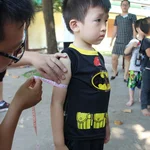 Measurement of middle upper arm circumference 