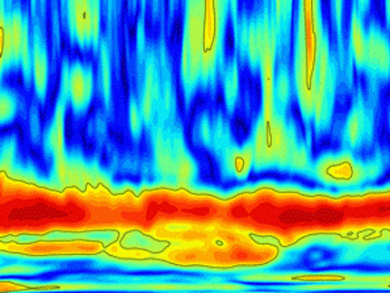 Wavelet eines mechanomyografisch erhobenen Signals