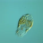 The rotifer Elosa spec.