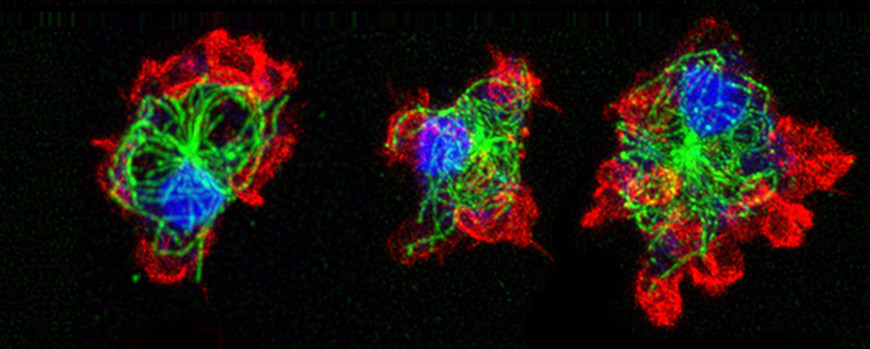 Dictyostelium amoebae with labeled cytoskeletal elements