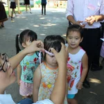 Measurement of head circumference