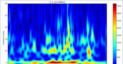 Wavelet einer Mechanomyografie Messung bei einem Probanden mit Schädel-Hirn-Trauma