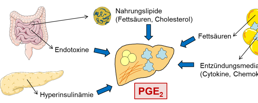 Modell: Einfluss von Nahrungsbestandteilen wie Fettsäuren und Cholesterol sowie bioaktiven Lipiden wie Prostaglandin E2 auf die Entstehung von Insulinresistenz und die Regulation der Entzündungsantwort bei der Diät-induzierten nicht-alkoholischen Fettlebererkrankung