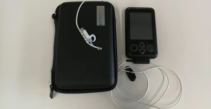 Vagusnervstimulator