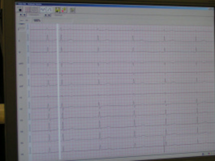 Ausdruck eines EKGs