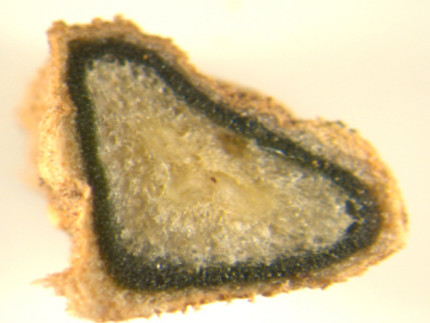 section of a cycadial root showing infection with cyanobacterial symbionts