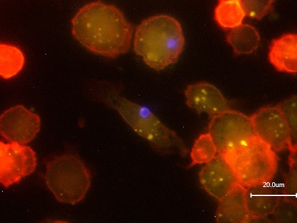 Fluoreszenzmikroskopische Aufnahme von Säugerzellen die Bead-markierte Antigene aufgenommen haben.