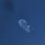 The ciliate Urosomoida spec.