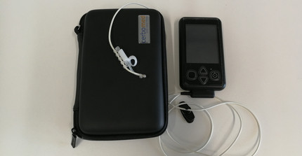 vagus nerve stimulator