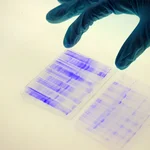 gel electrophoresis, photo: Karla Fritze
