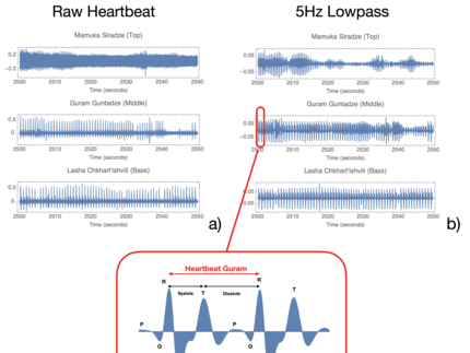 Preprocessing of the heartbeat recordings.