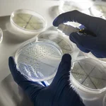 This photo shows several samples and hands wearing gloves in a biology laboratory.