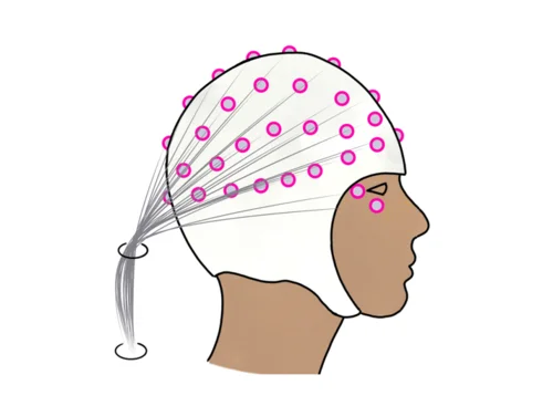 EEG