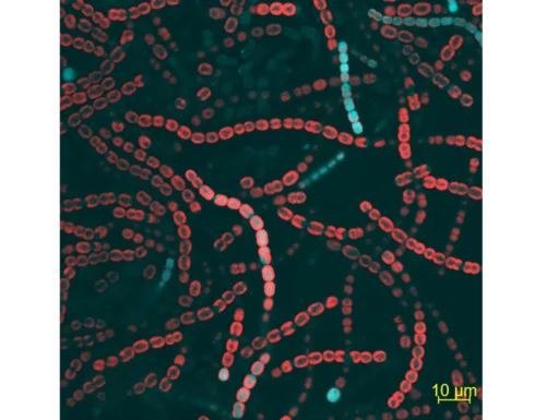 Micrograph of cyanobacterial mutant filament showing blue and red fluorescence