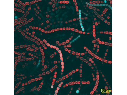 Micrograph of cyanobacterial mutant filament showing blue and red fluorescence