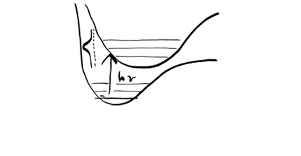 Sketch of a vibronic transition