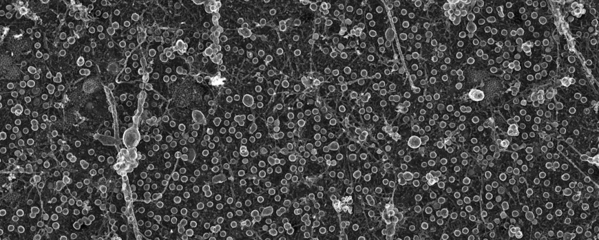 EM image of caveolae at the cytosolic plasma membrane leaflet of adipocytes.